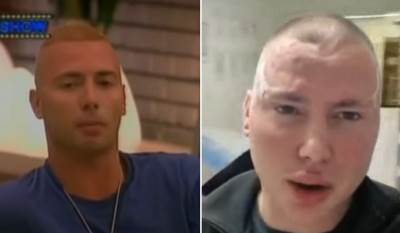  Branislav Radonjić Brendon intervenciju na licu 