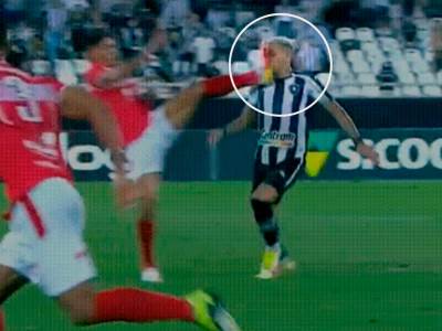  kramponom sijekao lice fudbaleru druga liga brazil fudbal 