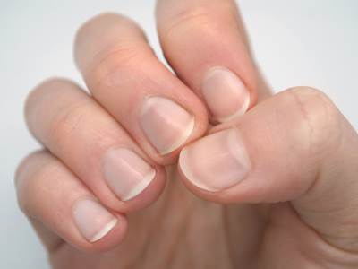  zdravlje dijebetes simptomi 