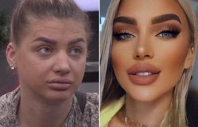  milica kemez i operacije 