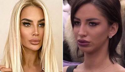  aleksandra nikolic zadruga operacije 