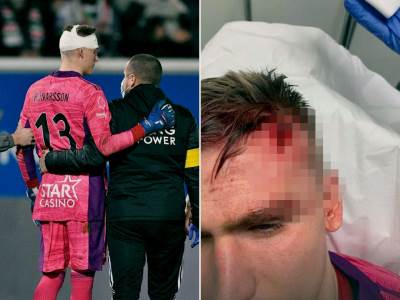  Aleks Runarson golman povreda 