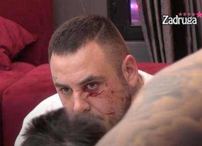  maja marinkovic izgrebala filipa cara po faci 