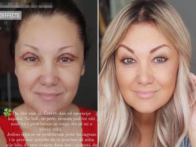  voditeljka nakon operacije 