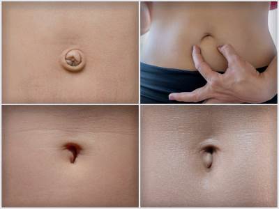  oblik pupka govori o vasoj licnosti 