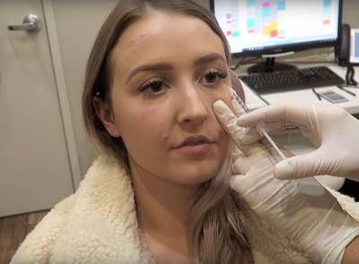  Gdje je opasno stavljati filere 