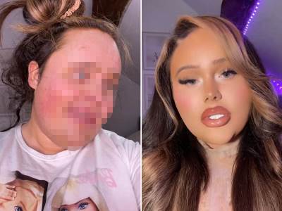  djevojka sa bradom transformacija 