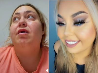  Transformacija devojke koja nema zube 