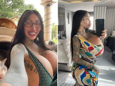  Meri Magdalena plasticne operacije  