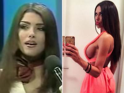  nekadasnja mis jugoslavije pretjerala sa operacijama 