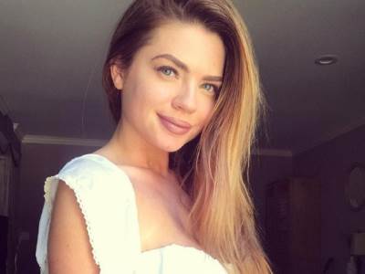  Ajvi otkazivali organi zbog lupusa 