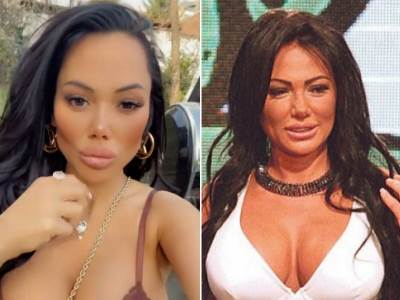  tamara djuric plasticne operacije 