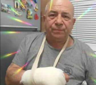  hasan dudić polomio ruku 