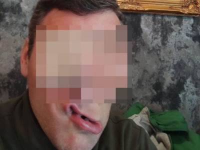  pevac koji je ranio mladice pokusao da pobjegne  