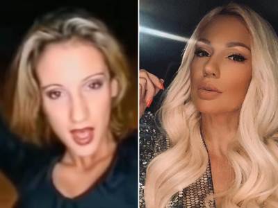  ana kokic prije plasticnih operacija 