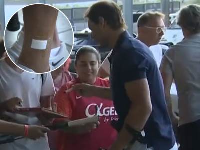  Rafael Nadal ne može da hoda  