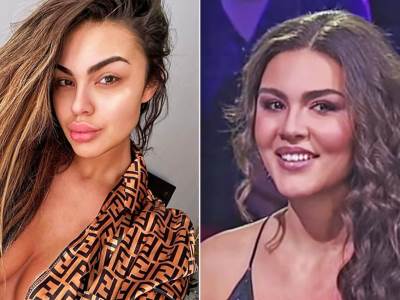  Eleonora Miljković nije krila da se podvrgla plastičnim operacijama 