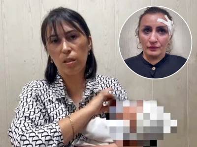  Žena iz Rusije prodala dijete da bi operisala nos 