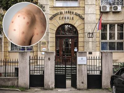  U Beogradu je prijavljena epidemija malih boginja 