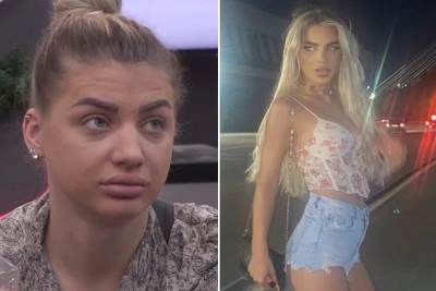  Milica Kemez nove plasticne operacije 