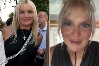  Vesna Da Vinča ujed ose 