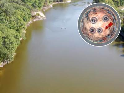  DJEČAK PREMINUO POSLE KUPANJA U RIJECI, NAPALA GA SMRTONOSNA AMEBA 