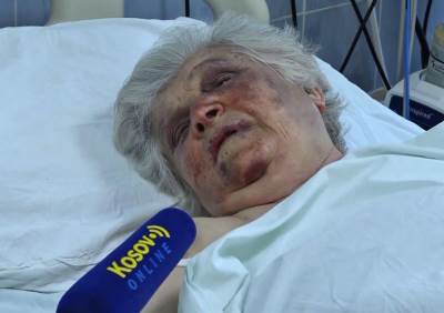  Božanu R. su pretukli provalnici tražeći od nje novac koji ona nije imala. 