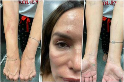  severina uhapsena u zagrebu 