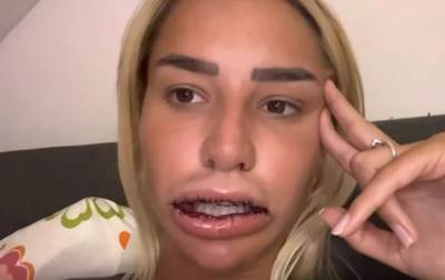  aleksandra nikolic poslije vadjenja biopolimera 