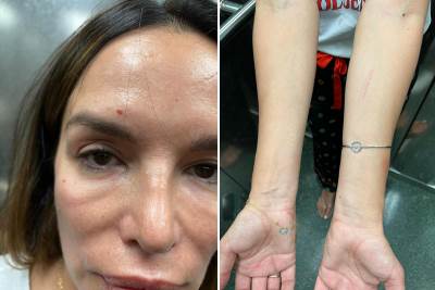  Oglasila se pravna zastupnica Severine Vučković nakon privođenja 