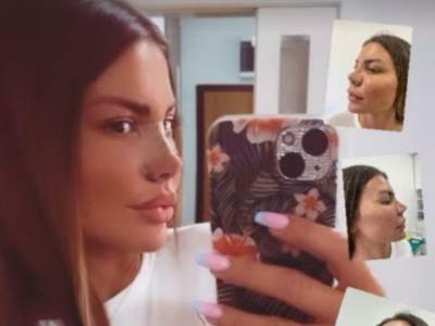  dragana mitar morala da ide na sedmu operaciju nosa kako ne bi ostala bez njega  