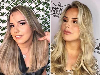  Marijana pokazala fotke pre i posle filera, posledice su JEZIVE 