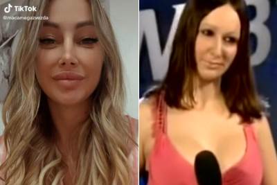  Maca Diskrecija je prije plastičnih operacija 