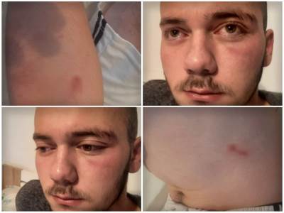  Otac prebijenog mladića sa Kosova o detaljima tuče 