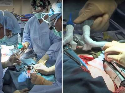  rumunski hirurzi koristili isti pejsmejker 