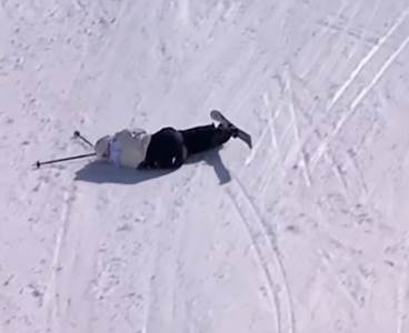  Na Kopaoniku skijaš doživio tešku povredu 