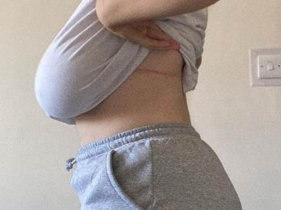  evo zasto je zenama jedna dojka veca od druge  