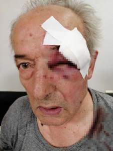  General u penziji u Beogradu zadobio teške tjelesne povrede, nakon dolaska iz bolnice ga sačeko  šok 