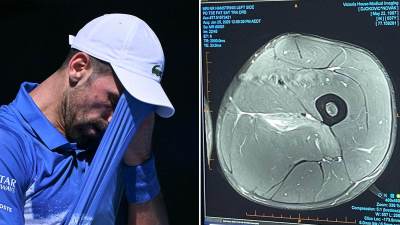  Novak Đoković objavio snimak povrede: Jednim potezom ućutkao sve "eksperte" 