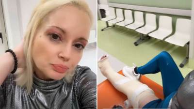  Nikolićeva o povredi noge 