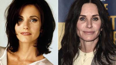  Monika iz "Prijatelja" unakazila lice estetskim zahvatima 