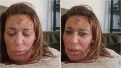  Ana Nikolić priznala da je nožem napala Raleta 