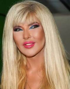  "Ljekari se na meni vežbali, bila sam zamorče": Jami konačno progovorila o estetskim intervencijama  