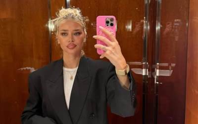  Sofiju Milošević razapeli na mrežama zbog botoksa: Slavnu ljepoticu gnusno vređaju, a evo koliko se  