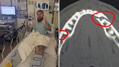  Entoni Džošua slomio vilicu Džejku Polu! 