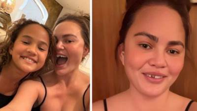  Krisi Tajgen ostala bez zuba  