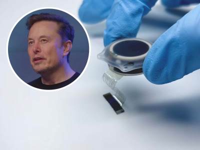  Neuralink pred velikim iskorakom 