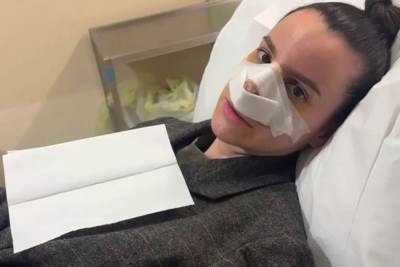  Tatjana Pejčić okrivila doktore da su joj uništili nos 