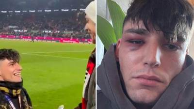  Pretučen fudbalski sudija koji je zaprosio dečka na stadionu 