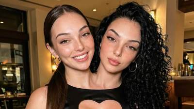  "Da li ste vi uopšte prave?!": Ljudi ne veruju koliko su sijamske bliznakinje lepe, stručnjak sve ra 